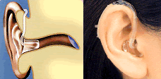 耳掛け補聴器